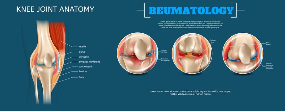 Realistic Banner Illustration Knee Joint Anatomy