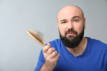 Man with hair loss problem on light background