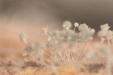 Rhizopus (bread mold) is a genus of common saprophytic fungi,Rhizopus (bread mold) under the microscope.