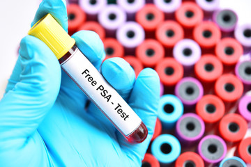 Fototapeta premium Blood sample for free PSA test, diagnosis for prostate cancer