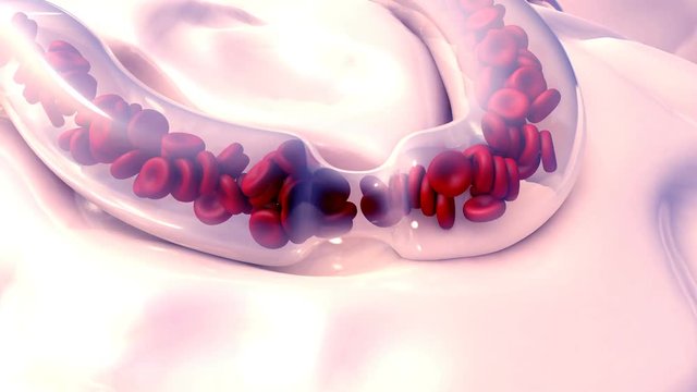 Blood Clots