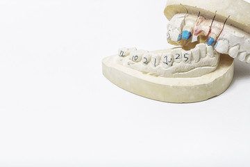 Plaster cast of teeth with space for your texts