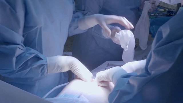 Medical Team Performing Surgical Operation in Bright Modern Operating Room.