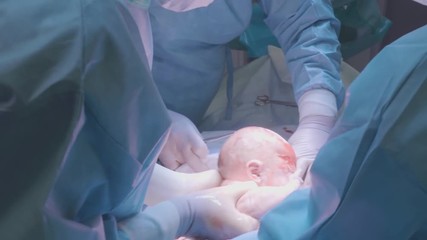 Surgical team performing surgery operation. Doctor performing surgery using sterilized equipment. Gynecologists and midwifes giving birth. Infant in maternity hospital