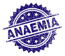 ANAEMIA stamp seal watermark with distress style. Blue vector rubber print of ANAEMIA title with unclean texture.