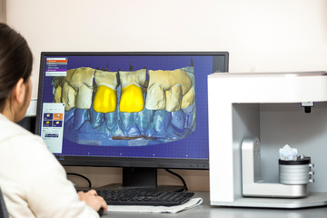 Person working on computer with dental software platform for mak
