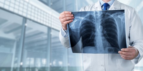 Xray radiology doctor hospital disease radiography ray