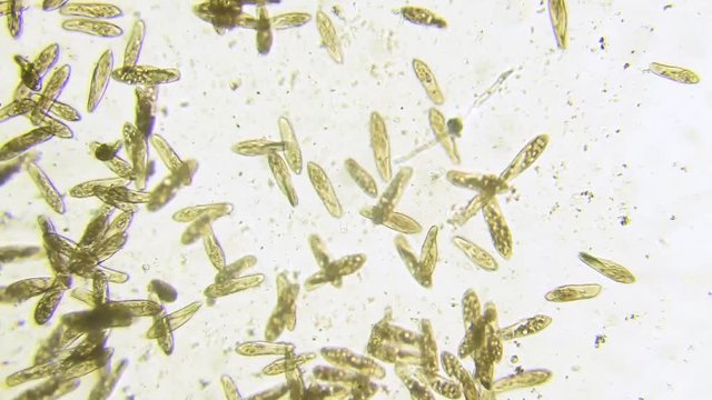 Microscope image footage of protozoa microorganisms in water, showing ciliates, paramecium, bacteria spirochaete and algae.