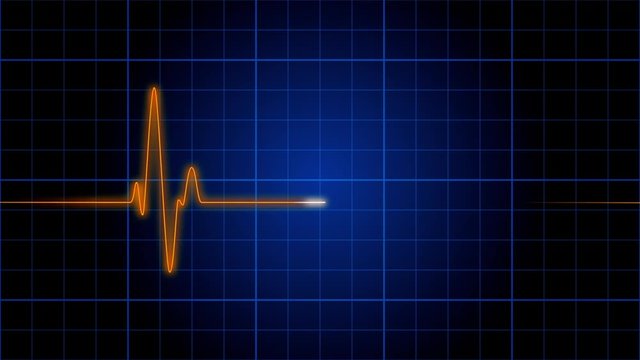 EKG 004: An electrocardiogram heart monitor pulses on a blue grid (Loop).