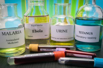 Tests for Research of Malaria, ebola, urine and tetanus