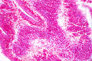 Tissue of small intestine or small bowel under the microscopic in Lab.