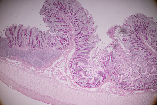 Tissue of small intestine or small bowel under the microscopic in Lab.