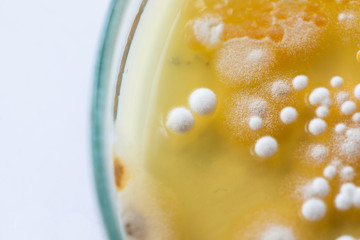 Colony characteristic of Actinomyces, Bacteria, yeast and Mold on selective media from soil samples for study in laboratory microbiology.