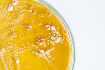 Colony characteristic of Actinomyces, Bacteria, yeast and Mold on selective media from soil samples...