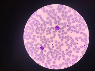 White blood cell