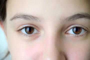 Beautiful kid eyes with long eyelash. closeup of brown eyes with pupil and eyebrow. Teenage ophthalmology. White caucasian children female face with open eyes. Healthy eyesight. Scin with rosacea