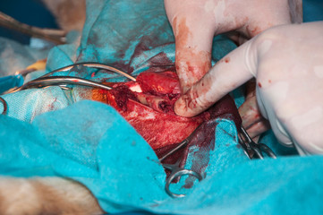 Fragment of open bone fracture. Operation of osteosynthesis