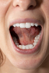 Macro of lower part of a woman's tongue