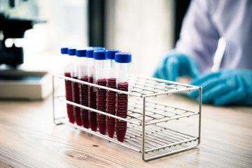 technician of health with blood tubes in the clinical lab for analytical , Medical, pharmaceutical and scientific research and development concept.