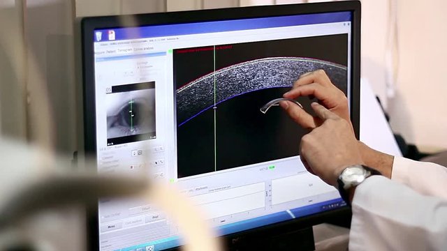 corneal wavefront analysis, Scanning the retina, Unrecognizable young female patient on a eye examination,  Medical attendance at the optometrist in a bright modern clinic