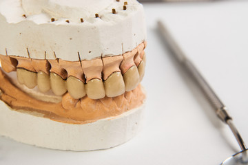Artificial dentition and instruments in dental laboratory. Denta