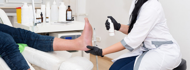 Podology treatment. Podiatrist treats foot. Podiatry doctor or dermatologist treats the patient in...