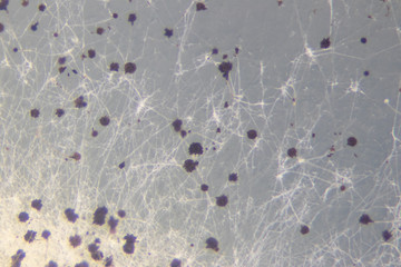 Backgrounds of Colony Characteristics of Rhizopus (bread mold) is a genus of common saprophytic fungi,Rhizopus (bread mold) under the microscope.