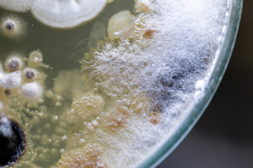 Backgrounds of Characteristics and Different shaped Colony of Bacteria and Mold growing on agar...