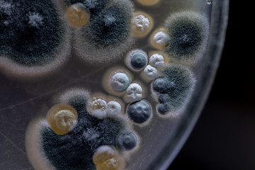 Backgrounds of Characteristics and Different shaped Colony of Bacteria and Mold growing on agar...