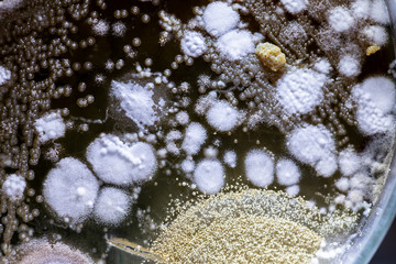 Backgrounds of Characteristics and Different shaped Colony of Bacteria and Mold growing on agar...