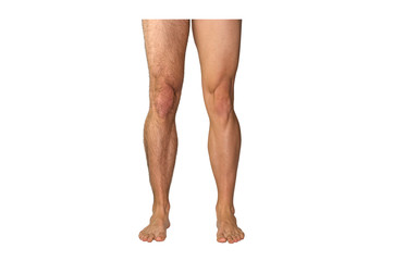 Caucasian legs of athletic man before and after shave on white background - obrazy, fototapety, plakaty