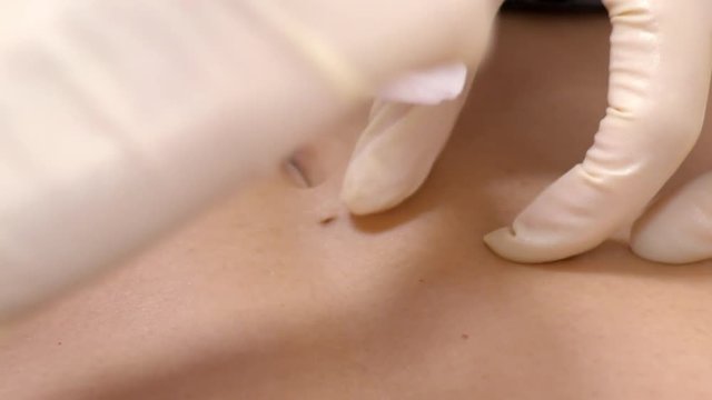 slow motion close view skilled specialist in sterile gloves wipes clients belly for disinfection while navel piercing 