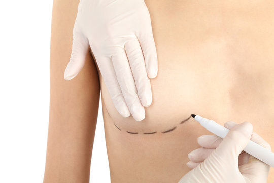 Doctor drawing marks on patient's breast for cosmetic surgery operation against white background, closeup
