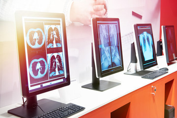 Computers with monitors for medicine