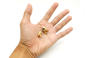 Decayed teeth placed on the hands