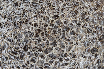 photographic image of bacteria infection under the microscope.