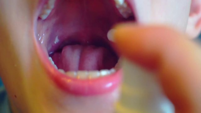 sore mouth and throat are treated with medication as a spray.close-up