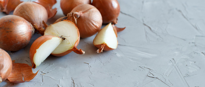 Yellow Onions On A Grey Board