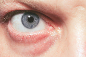 Human blue eye.