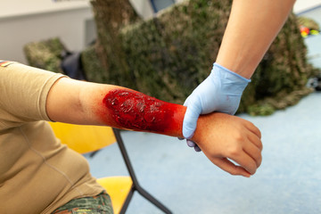 make up burn wound on a victim