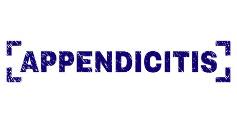 APPENDICITIS title seal print with corroded texture. Text title is placed between corners. Blue vector rubber print of APPENDICITIS with retro texture.