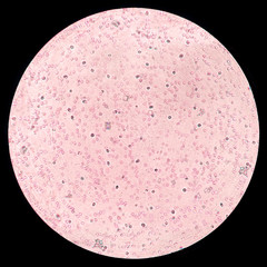 microscope image of blood during cross-match test