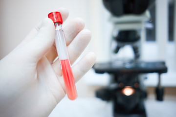 hadn with test tube full of blood, blood microscope diagnostics cross-test of Rh