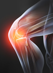 Painful knee joint, medically 3D illustration