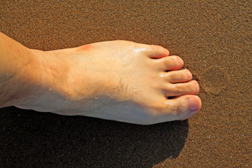 Men's foot on the sea beach