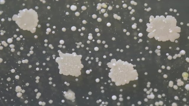Different shaped colonies of bacteria, yeast and mold growing on agar plates from environmental samples.