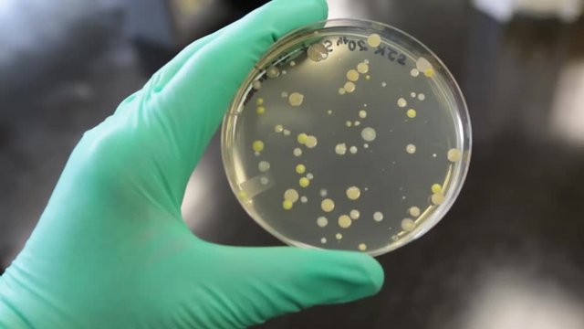 Different shaped colonies of bacteria, yeast and mold growing on agar plates from environmental samples.