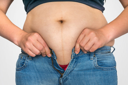 Overweight woman body with fat on belly - overweight concept