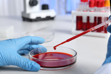 Laboratory worker pipetting blood sample into Petri dish for analysis on table, closeup