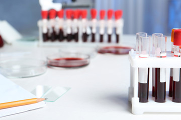 Test tubes with blood samples for analysis on table in laboratory. Space for text